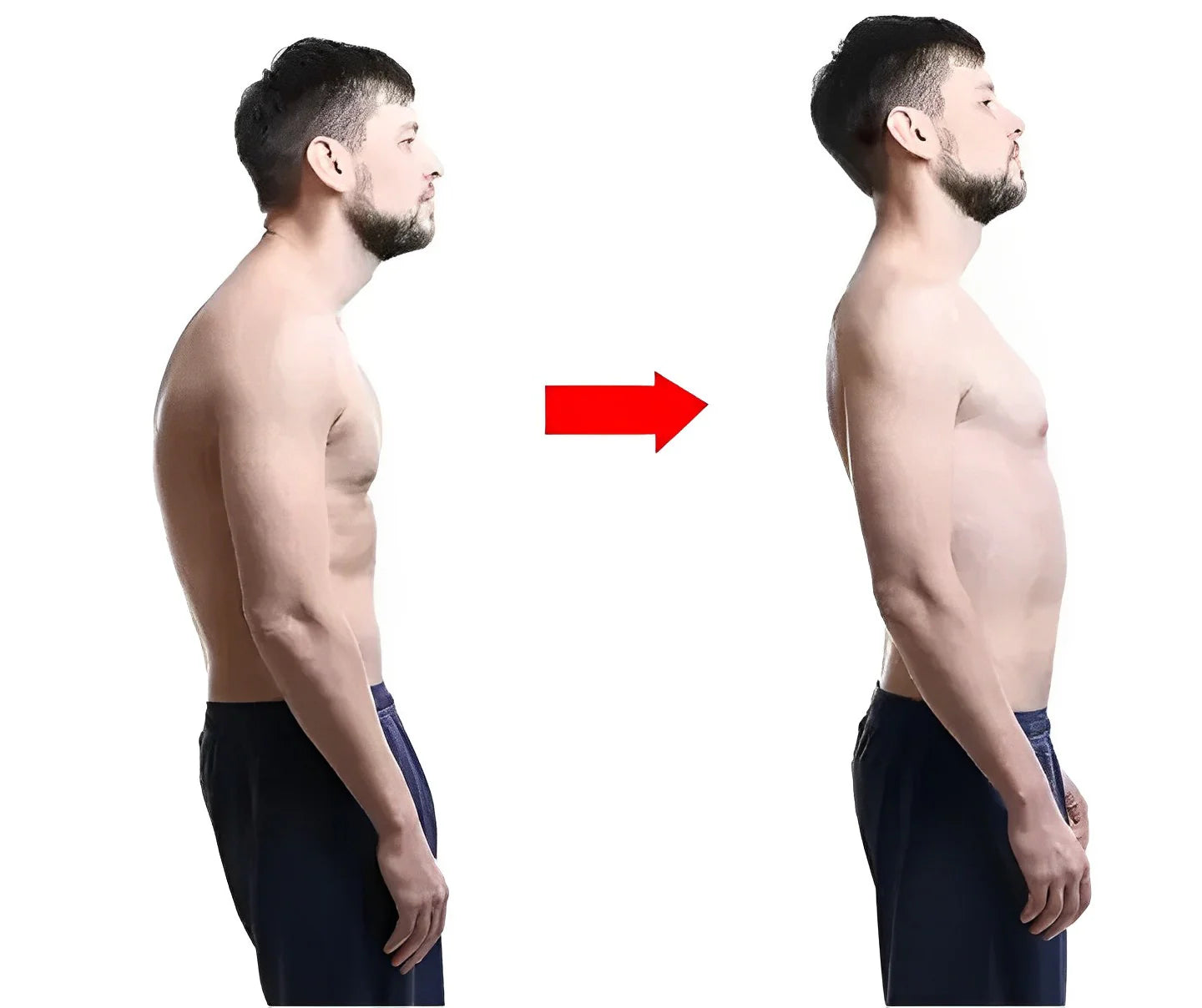 Corrector de postura ErgoFit™ de Commerly con correas ajustables y soporte lumbar visible en la imagen.